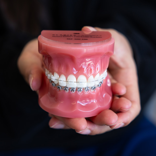 Braces or clear aligners: which is right for me? Braces or clear aligners: which is right for me?